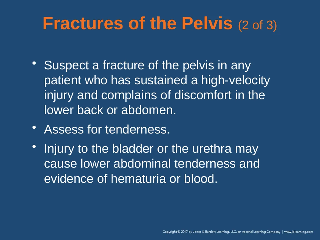 Chapter 31 Orthopaedic Injuries National EMS - slide 86 of 152