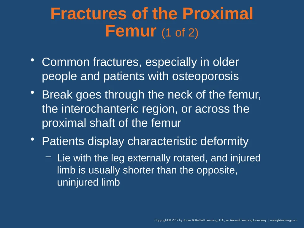 Chapter 31 Orthopaedic Injuries National EMS - slide 91 of 152