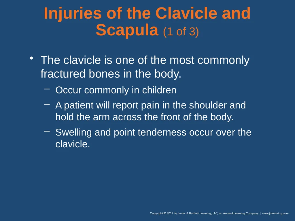 Chapter 31 Orthopaedic Injuries National EMS - slide 73 of 152