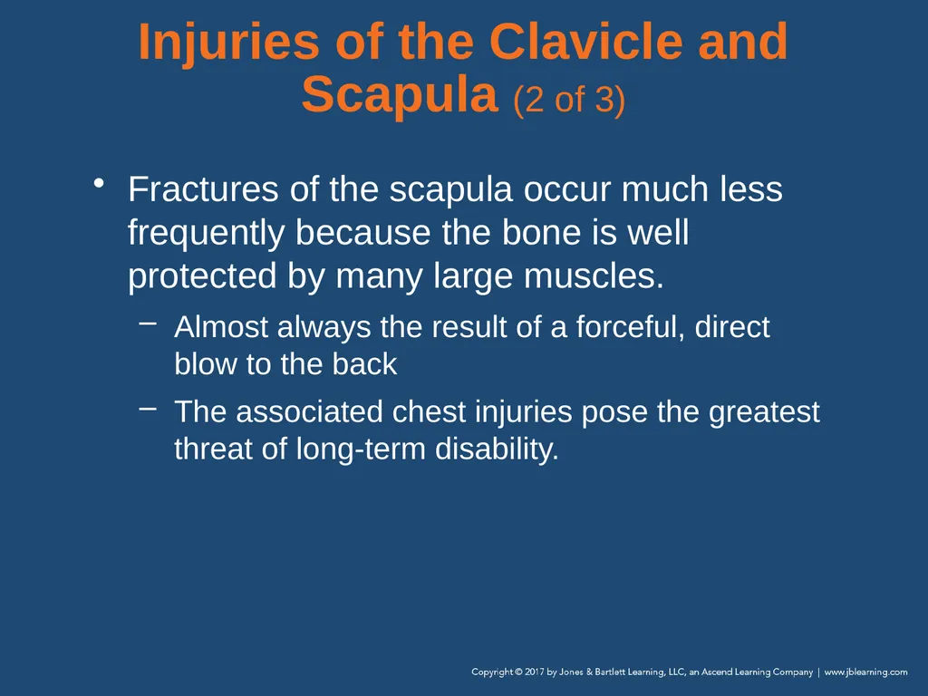 Chapter 31 Orthopaedic Injuries National EMS - slide 74 of 152