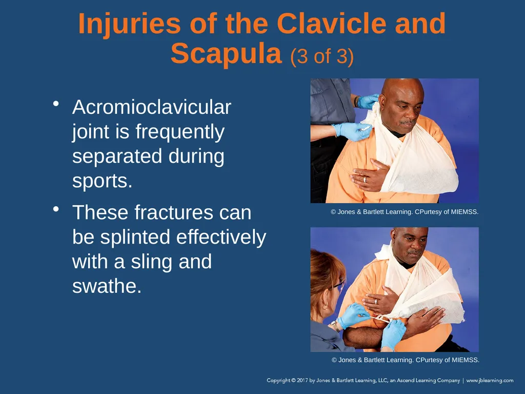 Chapter 31 Orthopaedic Injuries National EMS - slide 75 of 152