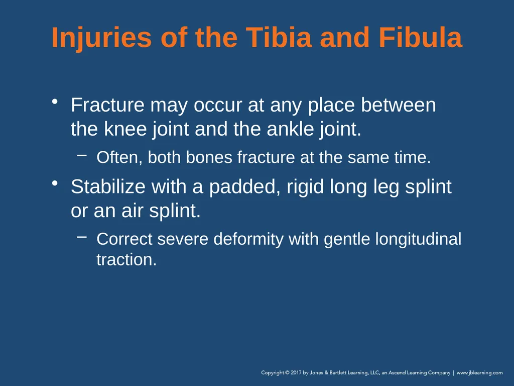 Chapter 31 Orthopaedic Injuries National EMS - slide 102 of 152