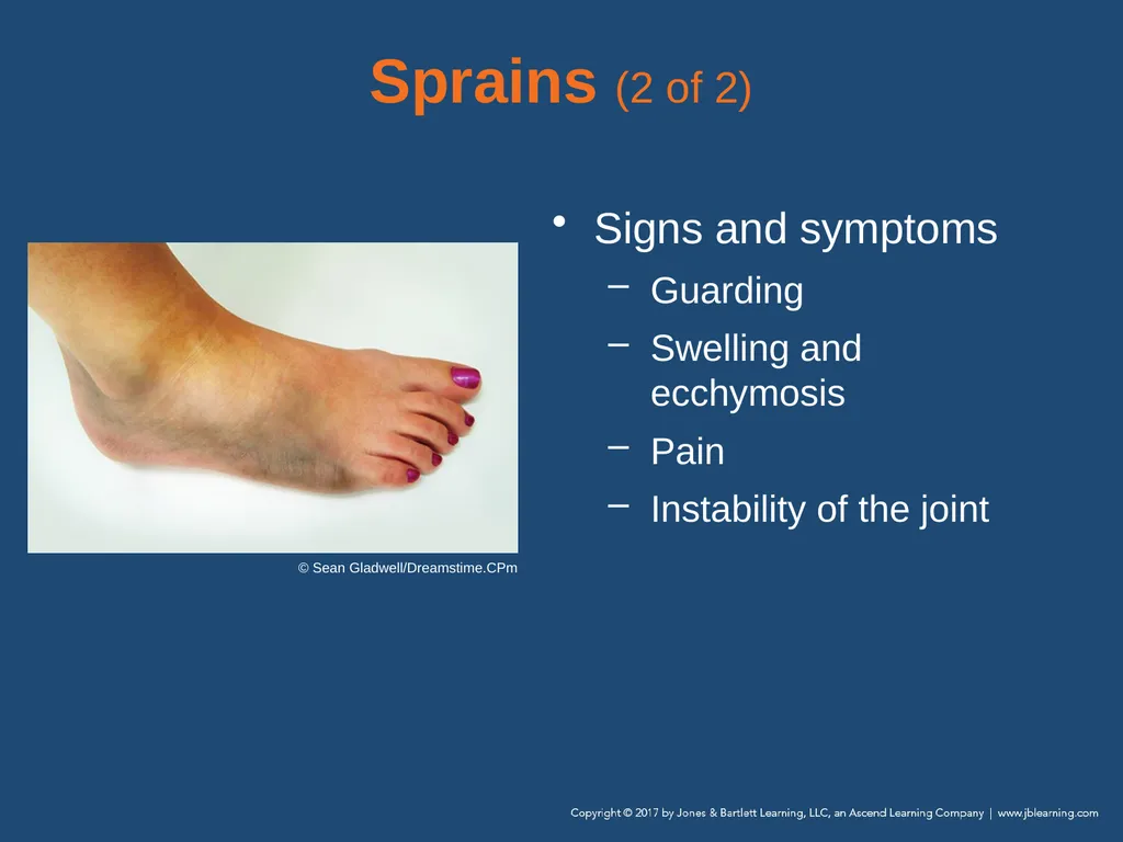 Chapter 31 Orthopaedic Injuries National EMS - slide 36 of 152