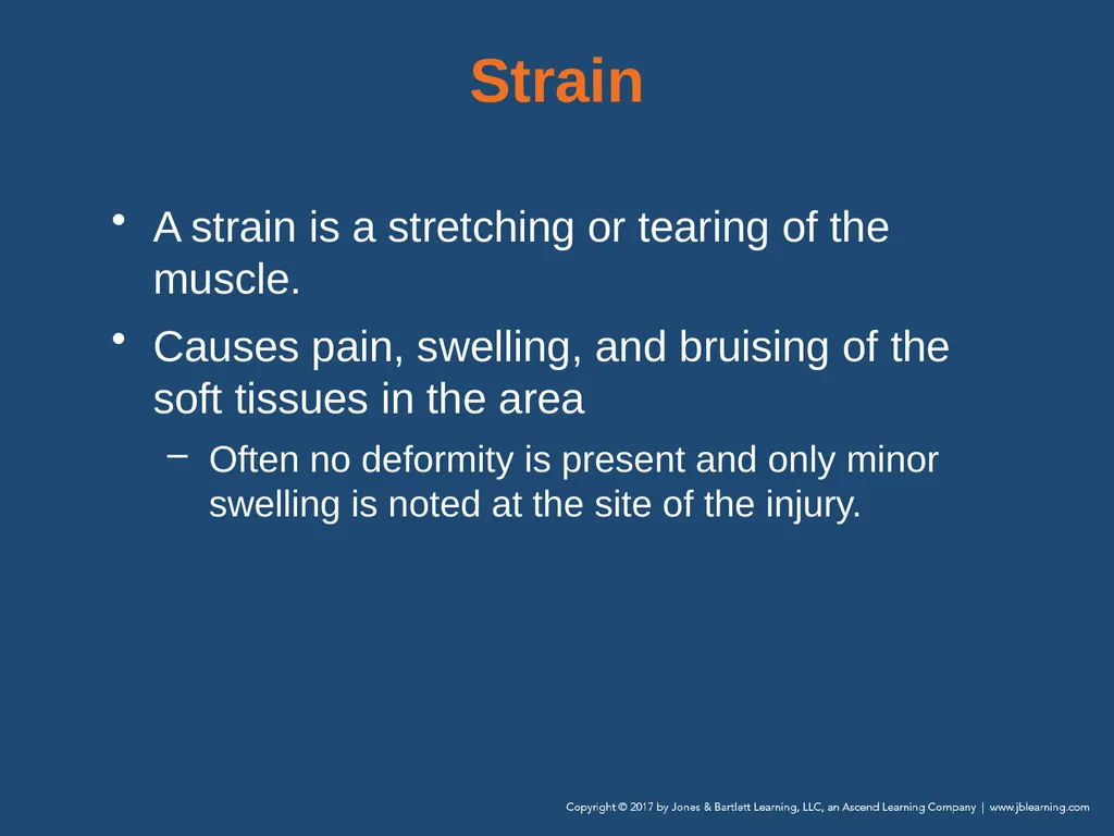 Chapter 31 Orthopaedic Injuries National EMS - slide 37 of 152
