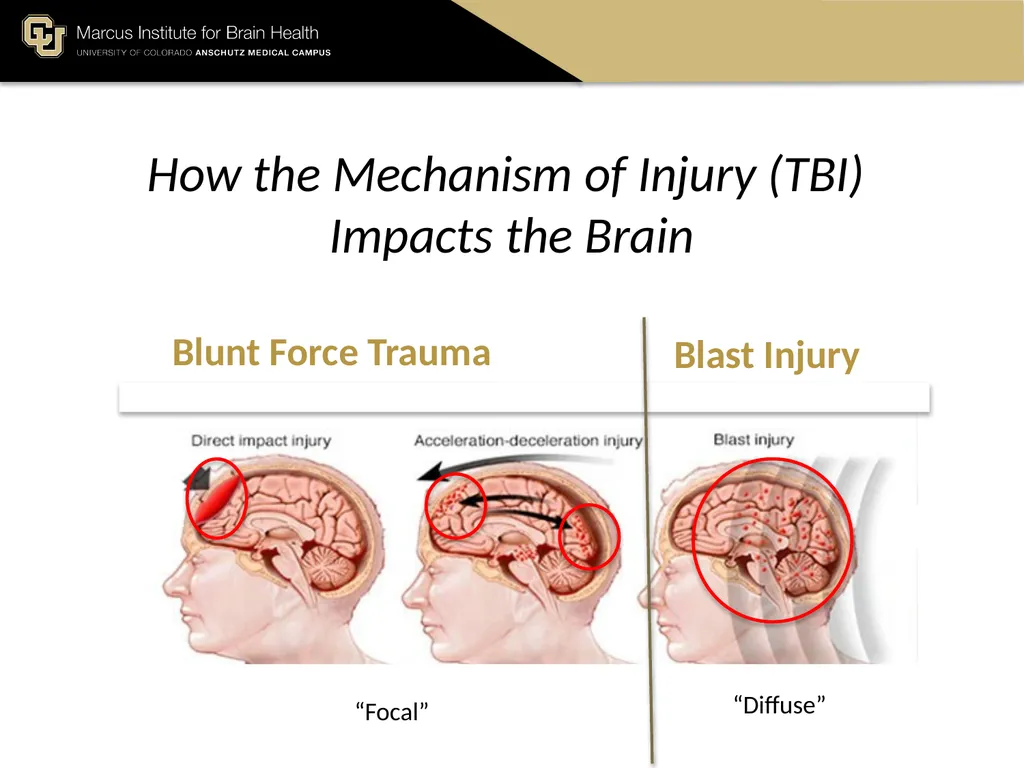 The Marcus Institute for Brain Health TBI 101 A - slide 5 of 23