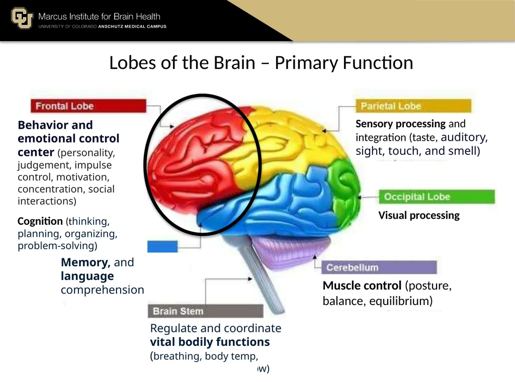 The Marcus Institute for Brain Health TBI 101 A - slide 6 of 23