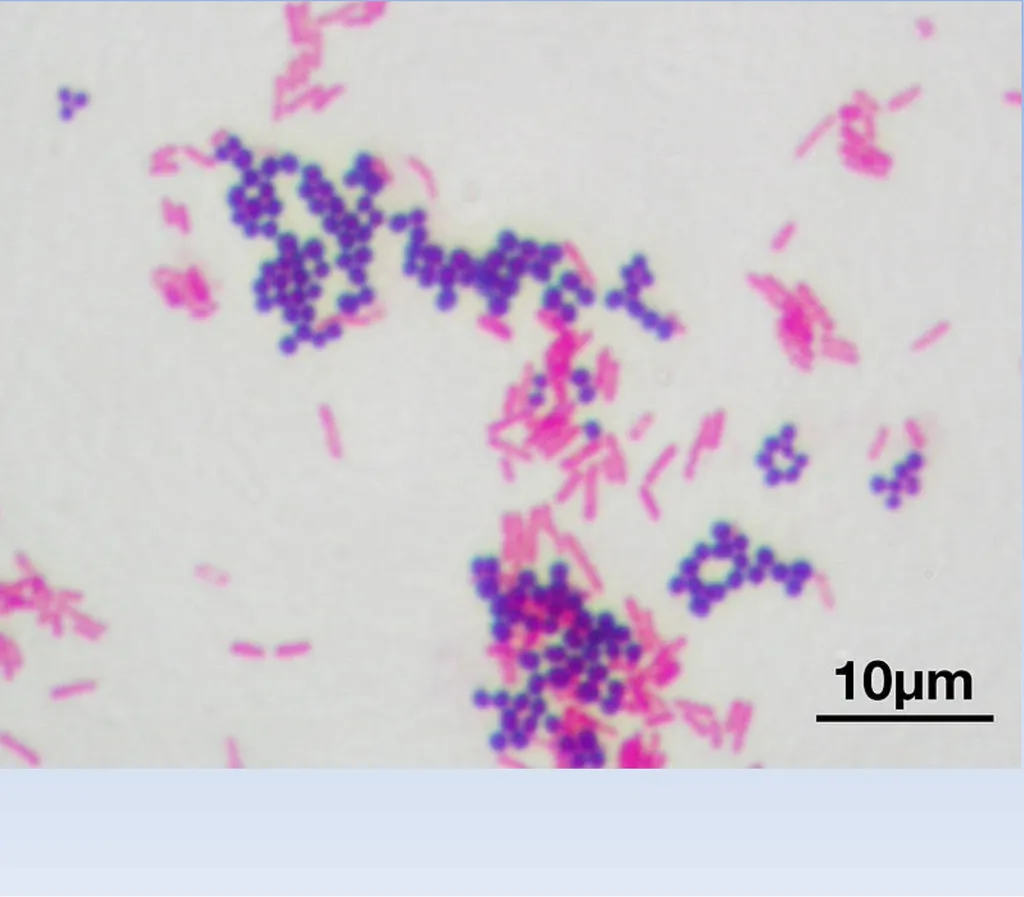 How to look at bacteria & Gram Staining There are - slide 11 of 22