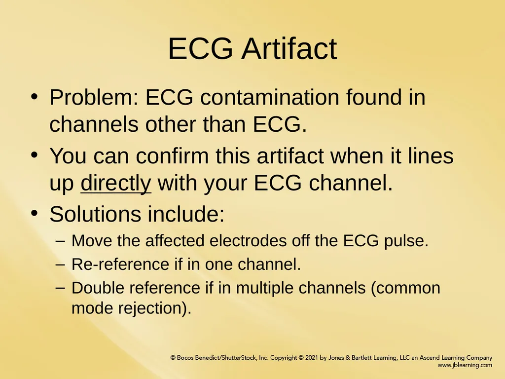Chapter 8 Artifacts and Troubleshooting Chapter - slide 6 of 19