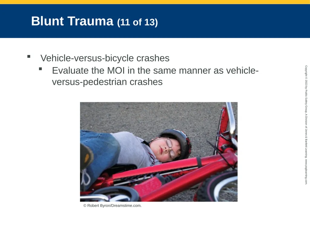 Trauma Overview CHAPTER 26: Focused Lecture - slide 20 of 45