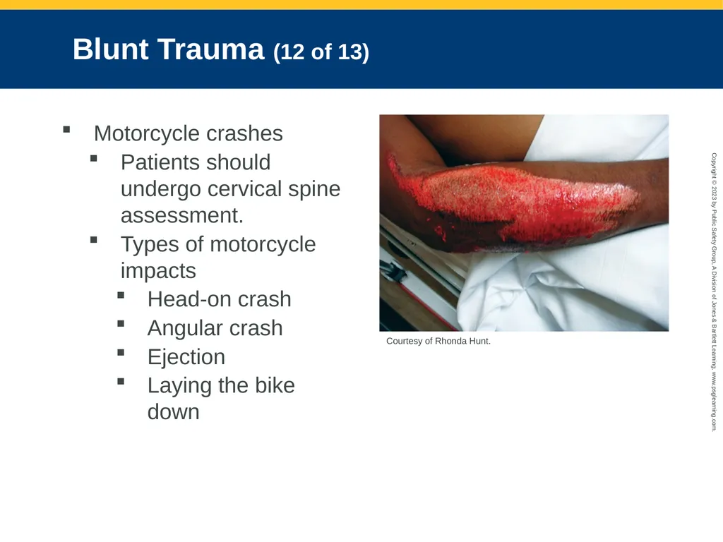 Trauma Overview CHAPTER 26: Focused Lecture - slide 21 of 45
