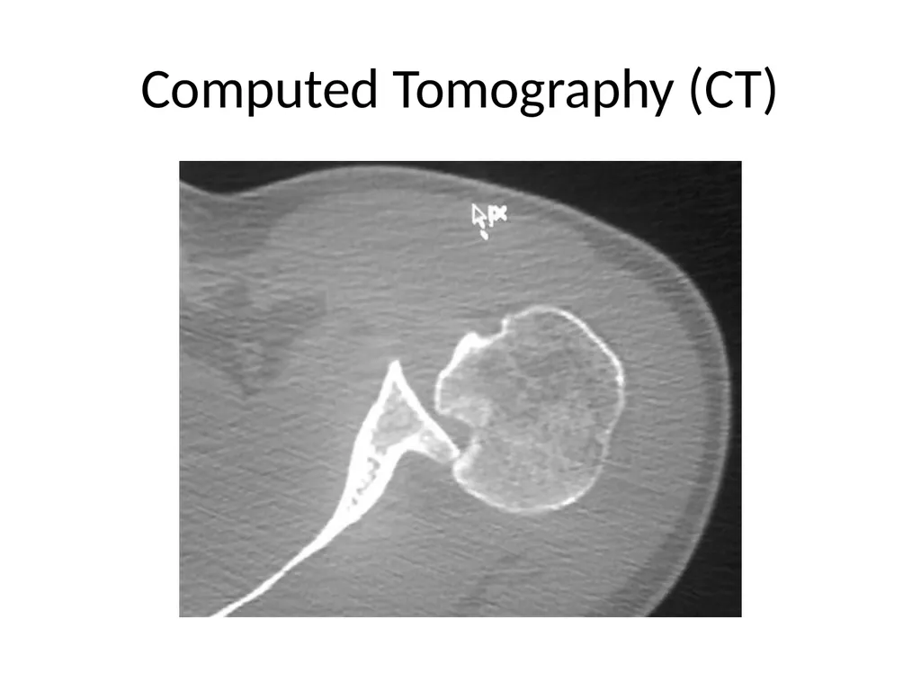 Shoulder Radiography What to consider when - slide 26 of 39