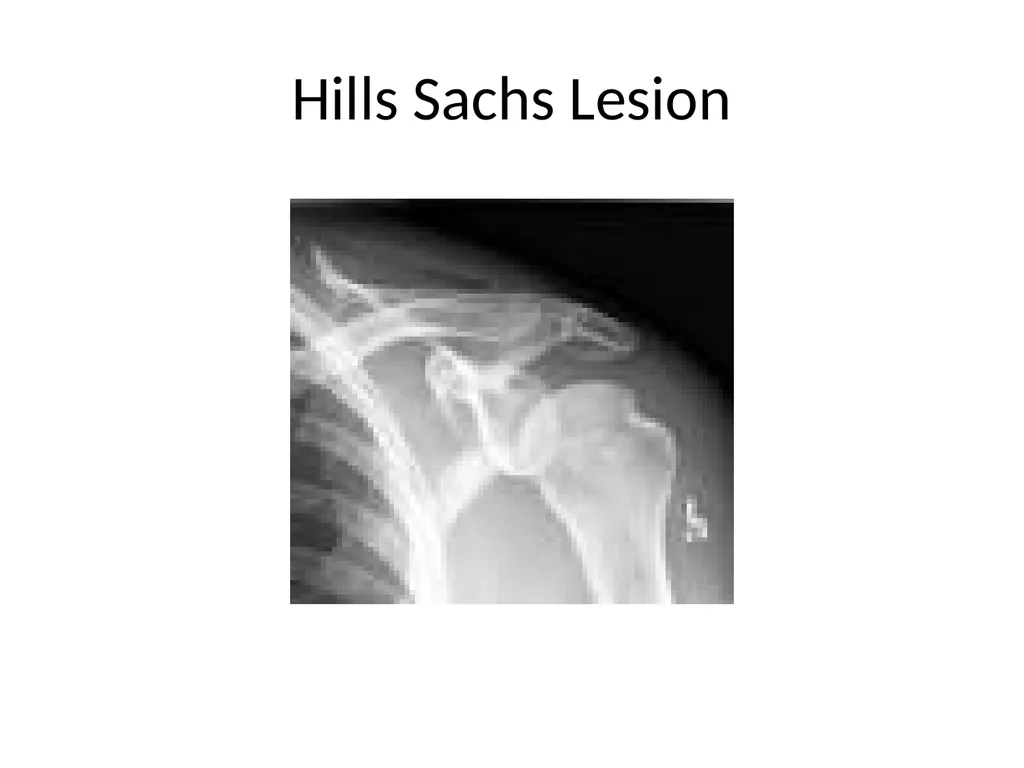 Shoulder Radiography What to consider when - slide 28 of 39