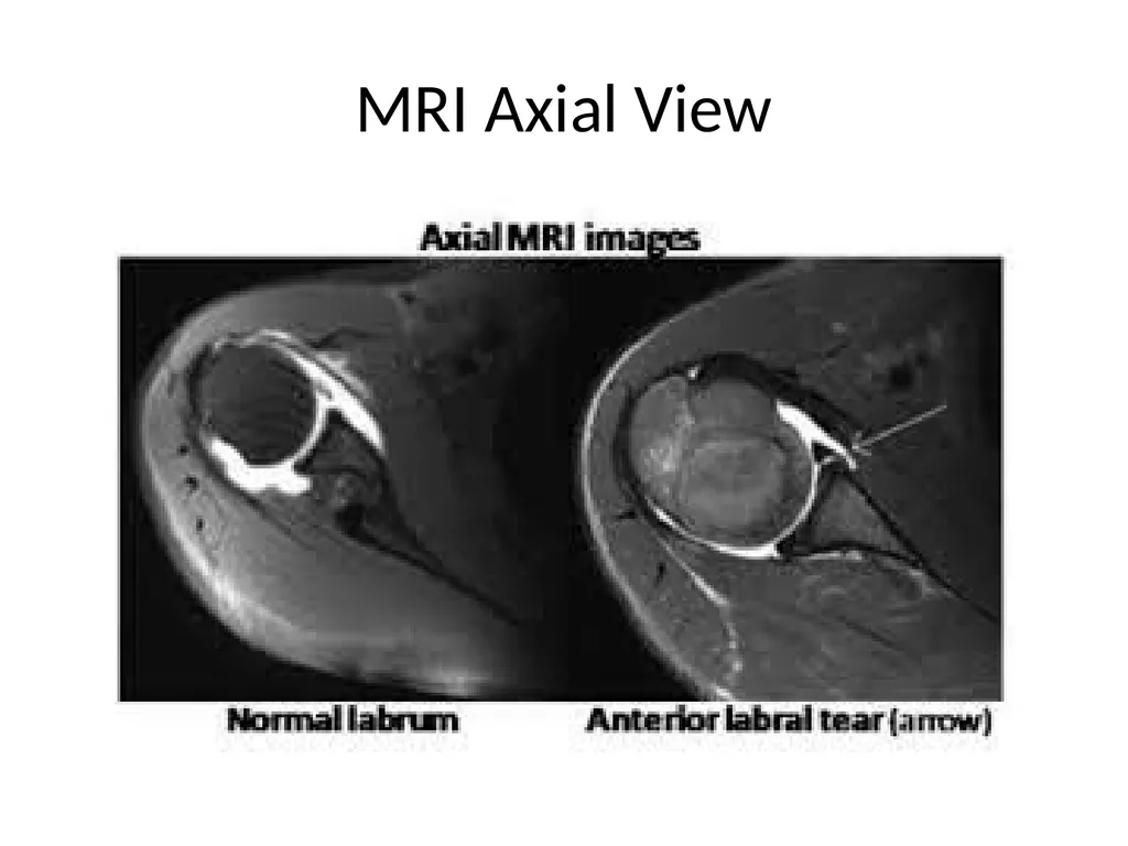 Shoulder Radiography What to consider when - slide 24 of 39