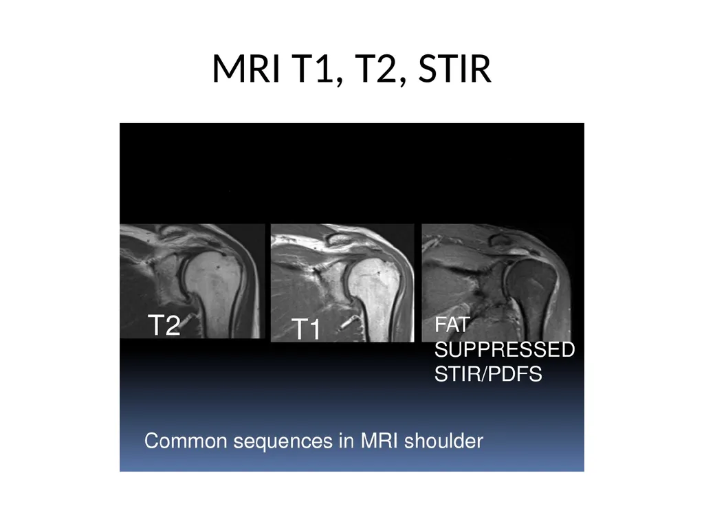 Shoulder Radiography What to consider when - slide 21 of 39