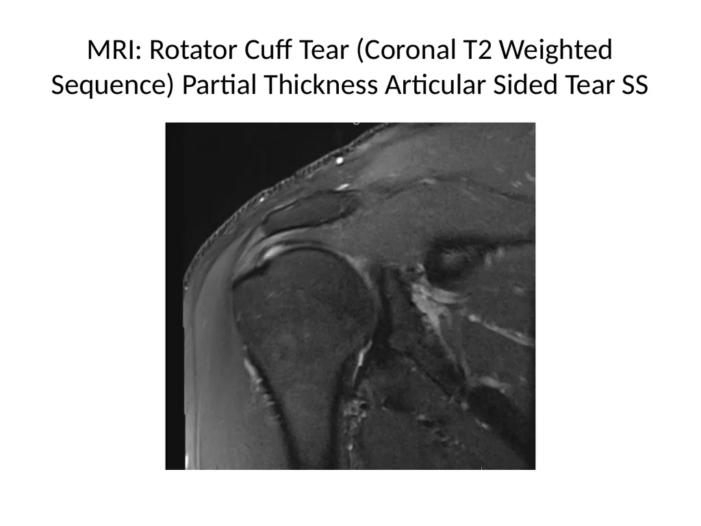 Shoulder Radiography What to consider when - slide 37 of 39