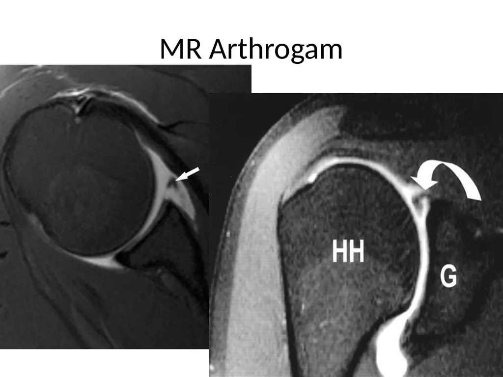 Shoulder Radiography What to consider when - slide 23 of 39