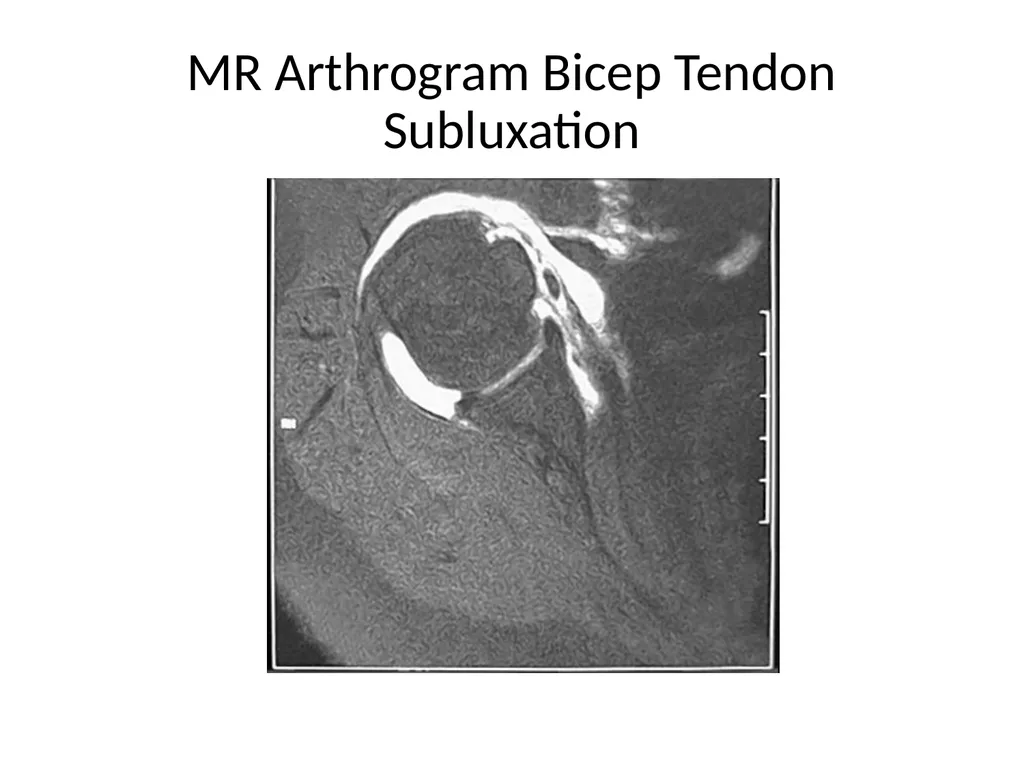 Shoulder Radiography What to consider when - slide 38 of 39