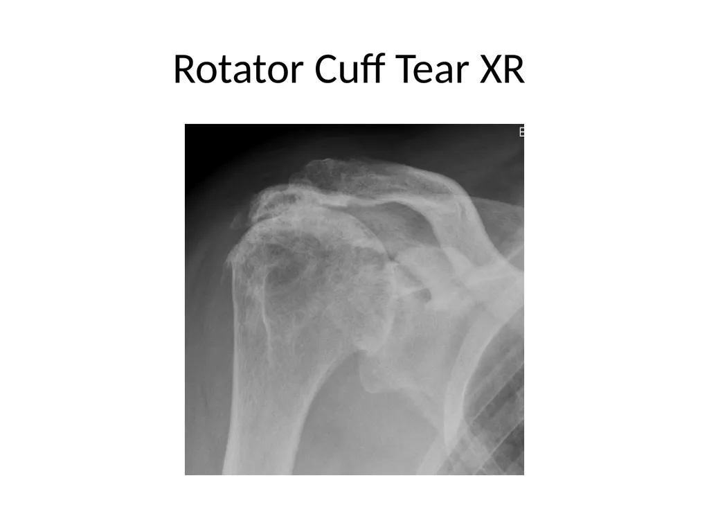 Shoulder Radiography What to consider when - slide 32 of 39