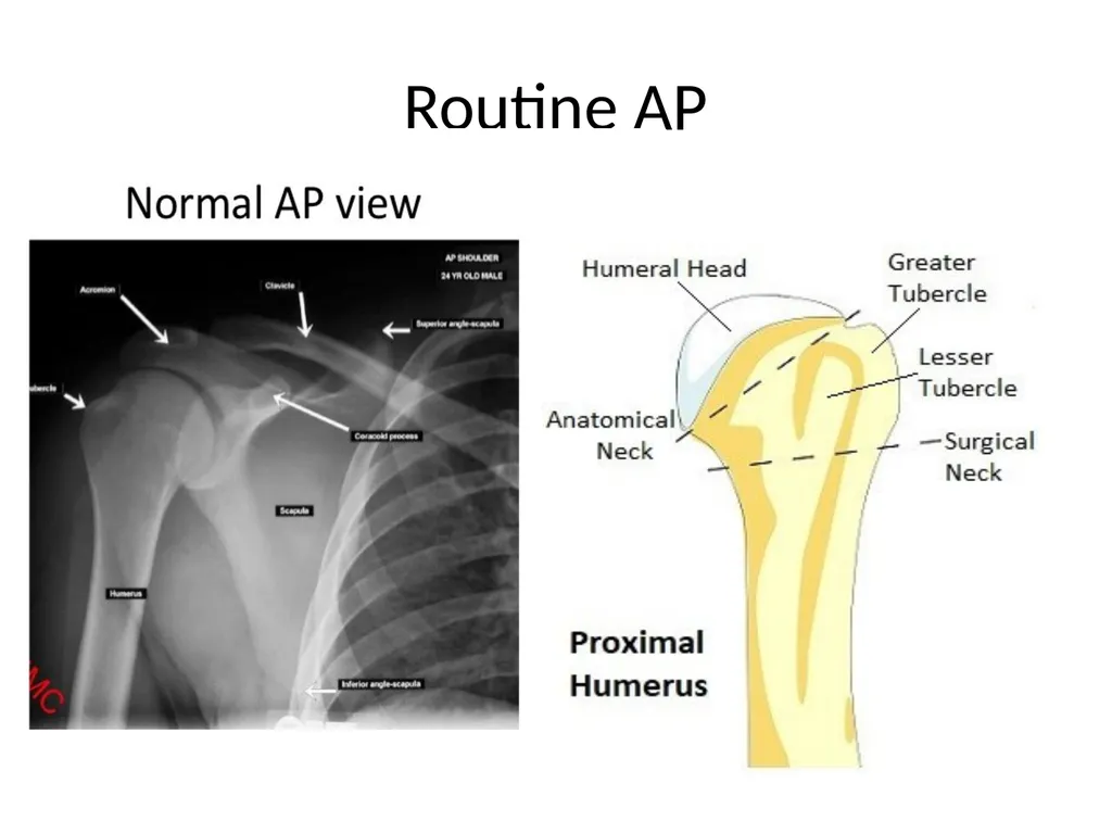 Shoulder Radiography What to consider when - slide 3 of 39
