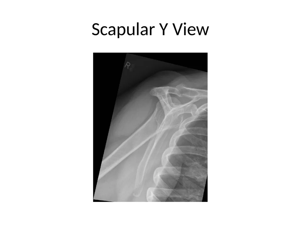 Shoulder Radiography What to consider when - slide 10 of 39