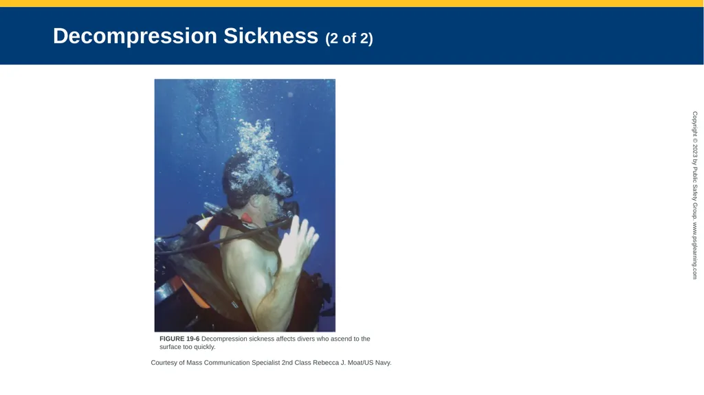 CHAPTER 19 Environmental Emergencies Introduction - slide 59 of 72