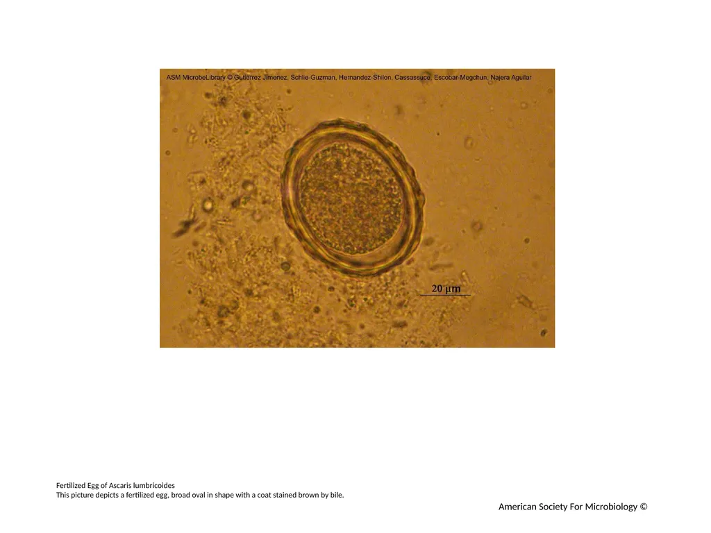 Ascaris lumbricoides Development Authors: Javier - slide 5 of 12