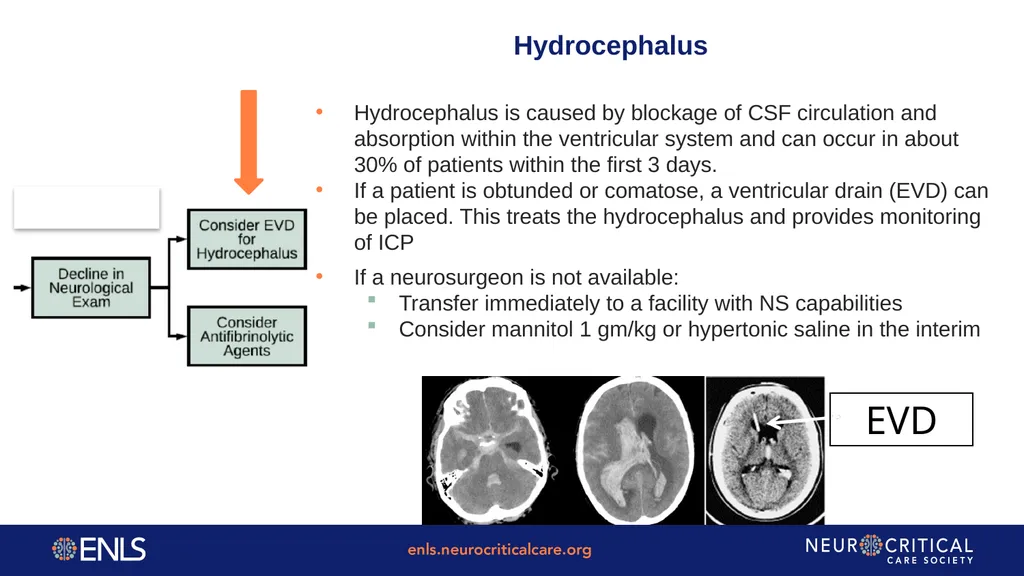 ENLS Version 5.0 Subarachnoid Hemorrhage Content: - slide 33 of 43