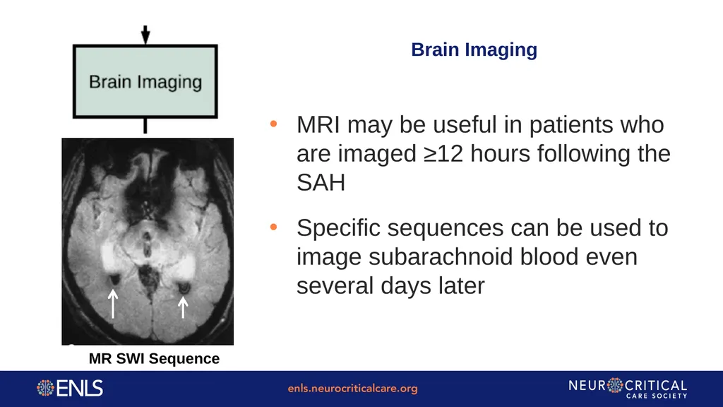 ENLS Version 5.0 Subarachnoid Hemorrhage Content: - slide 18 of 43