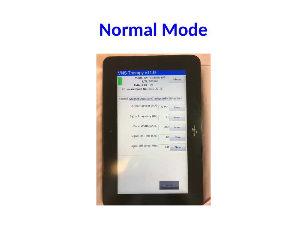 Getting comfortable with VNS Programming Edward - slide 6 of 20