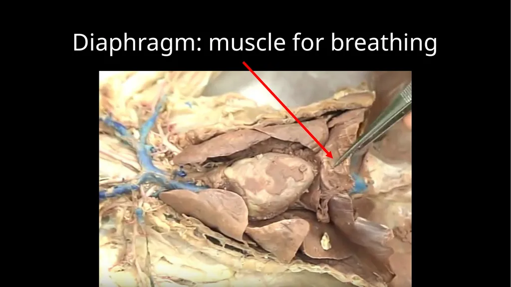Respiratory System Dissection Larynx (region): - slide 9 of 10