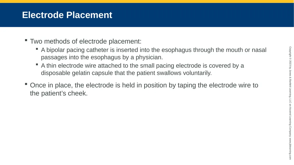 CHAPTER 17 Temporary Pacing and Cardioversion - slide 25 of 38