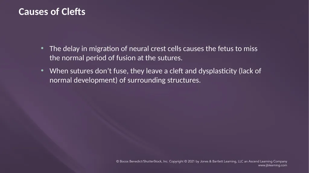 Chapter 3: Clefts of the Lip and Palate Chapter 3: - slide 16 of 64