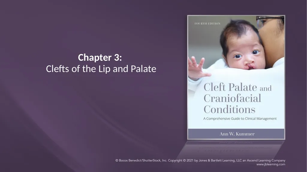 Chapter 3: Clefts of the Lip and Palate Chapter 3: - slide 1 of 64