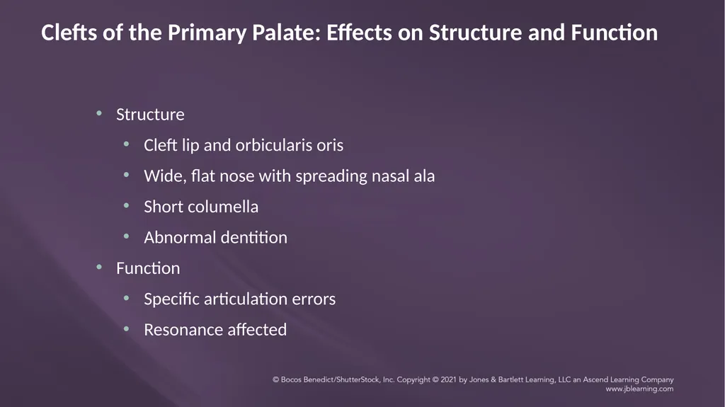 Chapter 3: Clefts of the Lip and Palate Chapter 3: - slide 33 of 64