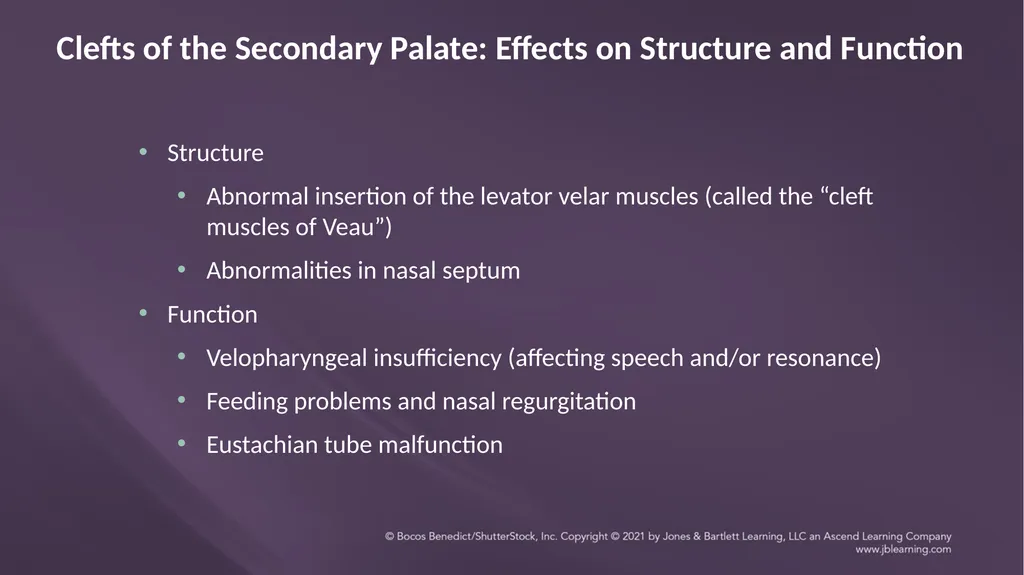 Chapter 3: Clefts of the Lip and Palate Chapter 3: - slide 41 of 64