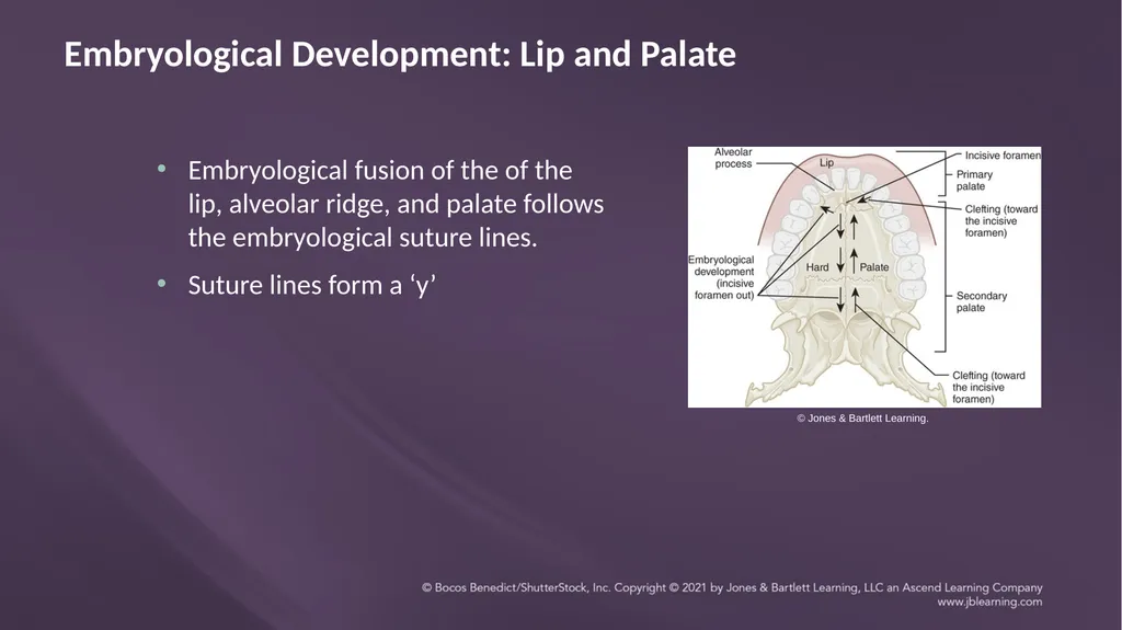 Chapter 3: Clefts of the Lip and Palate Chapter 3: - slide 5 of 64
