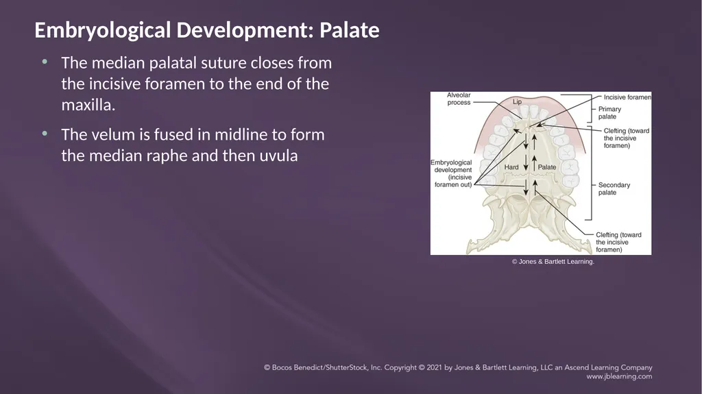 Chapter 3: Clefts of the Lip and Palate Chapter 3: - slide 10 of 64