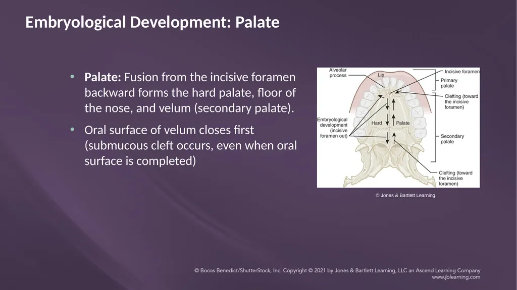 Chapter 3: Clefts of the Lip and Palate Chapter 3: - slide 9 of 64