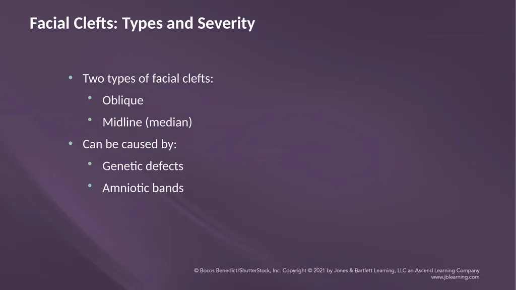 Chapter 3: Clefts of the Lip and Palate Chapter 3: - slide 53 of 64