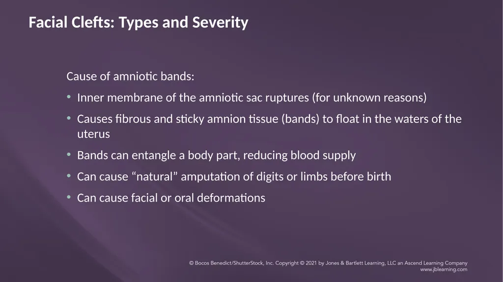 Chapter 3: Clefts of the Lip and Palate Chapter 3: - slide 54 of 64