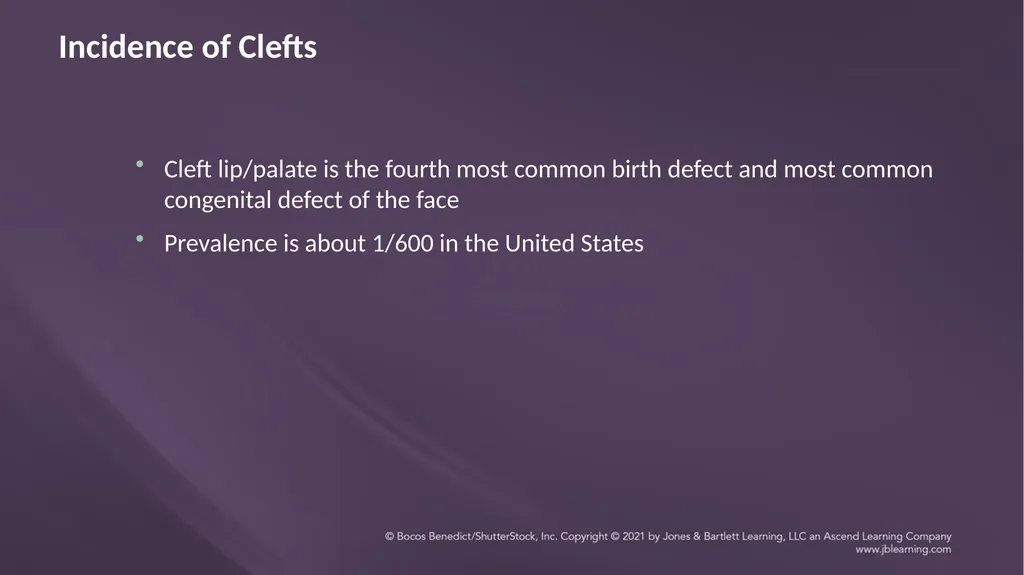 Chapter 3: Clefts of the Lip and Palate Chapter 3: - slide 60 of 64