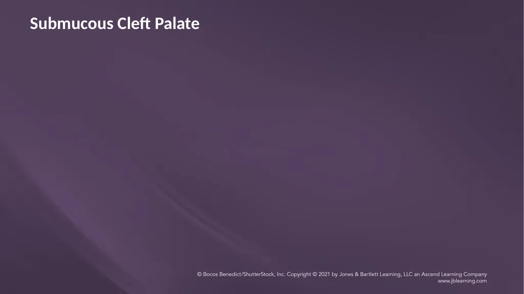 Chapter 3: Clefts of the Lip and Palate Chapter 3: - slide 42 of 64