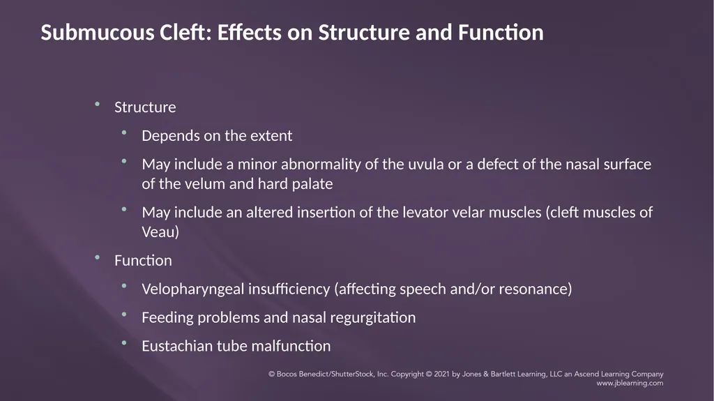 Chapter 3: Clefts of the Lip and Palate Chapter 3: - slide 51 of 64