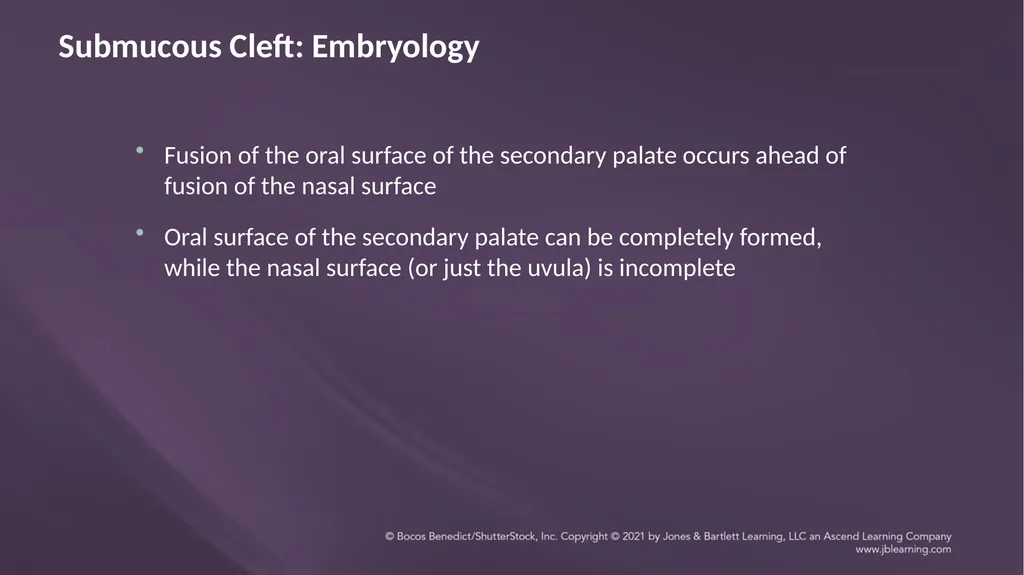 Chapter 3: Clefts of the Lip and Palate Chapter 3: - slide 43 of 64