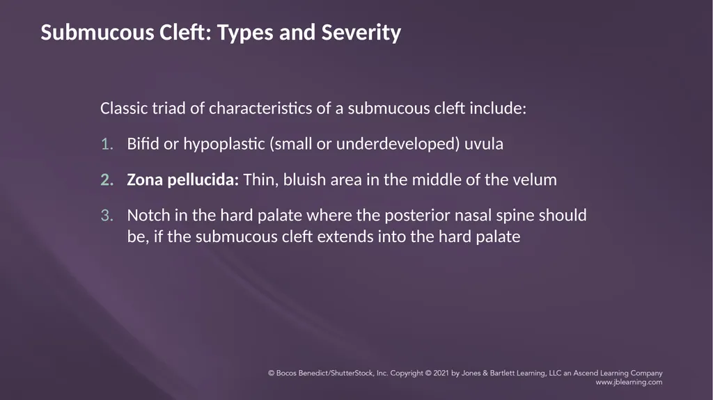 Chapter 3: Clefts of the Lip and Palate Chapter 3: - slide 44 of 64