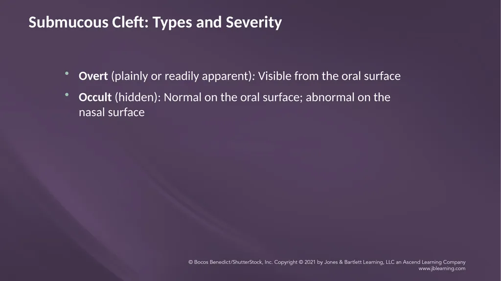 Chapter 3: Clefts of the Lip and Palate Chapter 3: - slide 50 of 64
