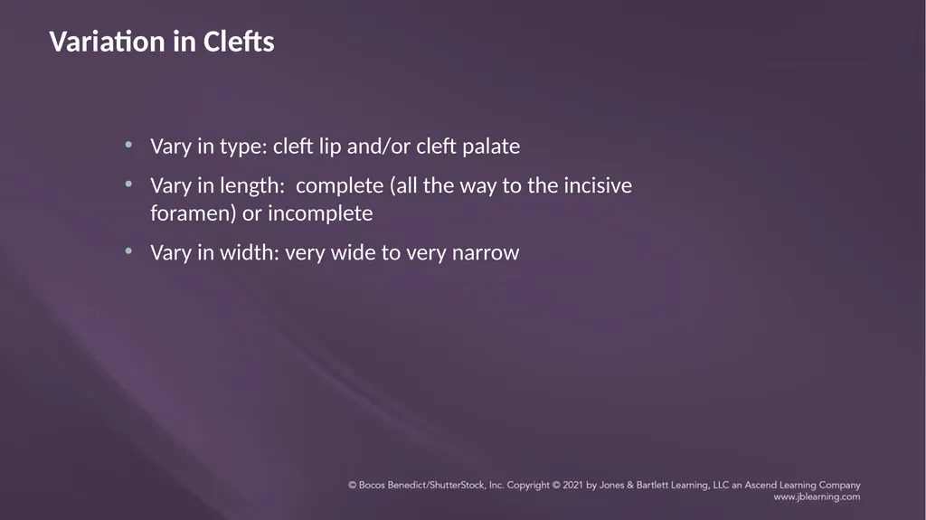 Chapter 3: Clefts of the Lip and Palate Chapter 3: - slide 12 of 64