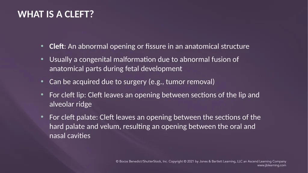 Chapter 3: Clefts of the Lip and Palate Chapter 3: - slide 11 of 64