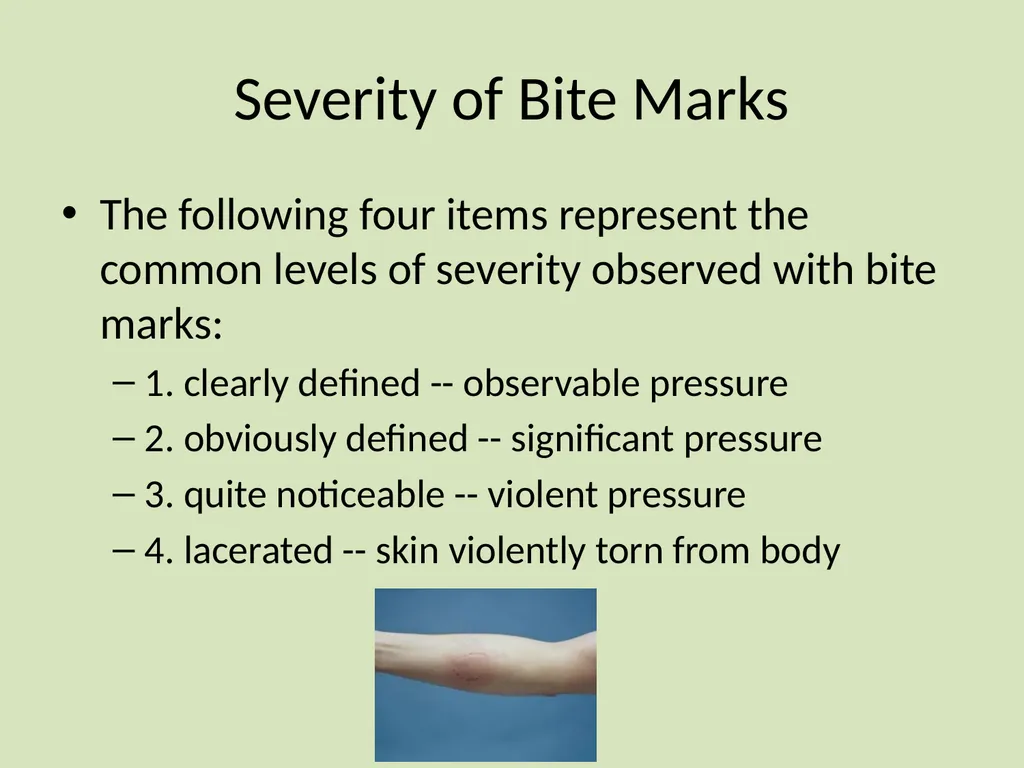 Dental Identification and Lip Prints Original - slide 10 of 14