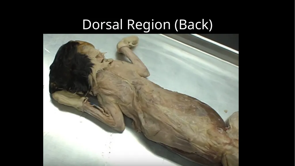 External Structures Dorsal Region (Back) Ventral - slide 2 of 16